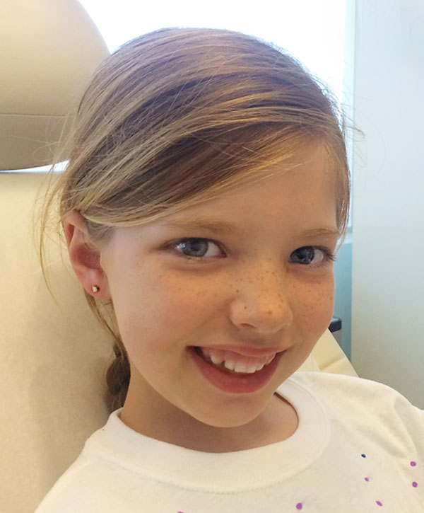Manhattan Dermatology Patient Microneedling