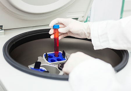 Centrifuge for PRP