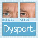 Dysport
