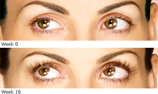 Latisse Before + After